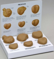 Prostate Pharmaceutical and Anatomical Model Gifts